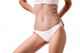 Liposuction